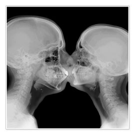 Plakat  X-ray of a couple kissing - PhotoStock-Israel